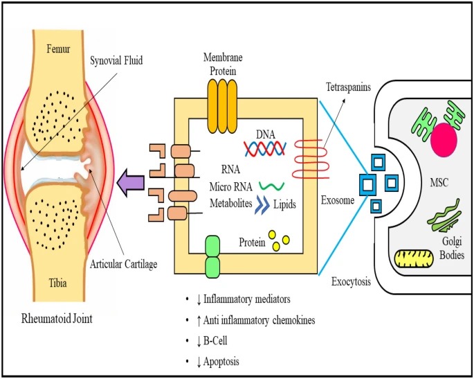 How exosomes work in arthritis